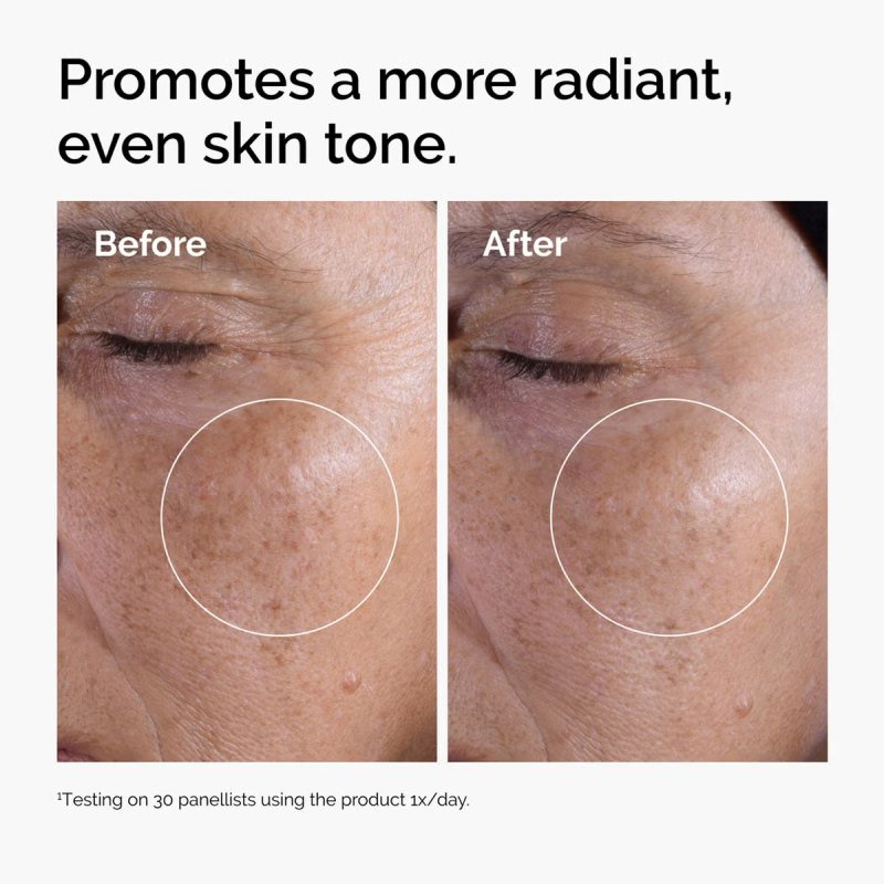 The Ordinary Glycolic Acid 7% Exfoliating Toner — view 3